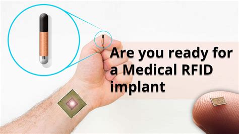 rfid human chip 2020|On Emerging Technology: What to Know When Your Patient Has .